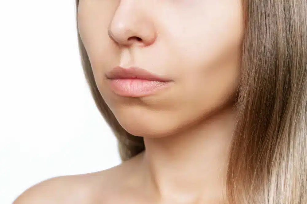 Woman with defined cheekbones considering buccal fat removal surgery to achieve slimmer lower face contour