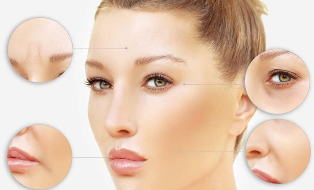 Certain areas of the face, such as the forehead and around the eyes, are known as danger zones since they are susceptible to potential side effects from Botox
