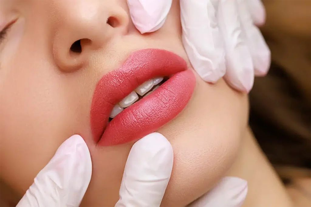 The Cupid's Bow Lip Lift is a surgical procedure that involves shortening the distance between the nose and the upper lip, resulting in a more defined and youthful appearance.