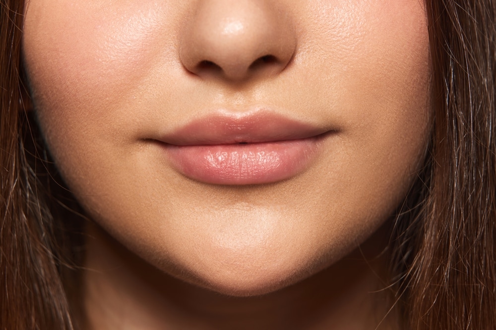 Close-up of smooth, symmetrical lips showing minimal scarring after expert lip lift scar revision surgery.
