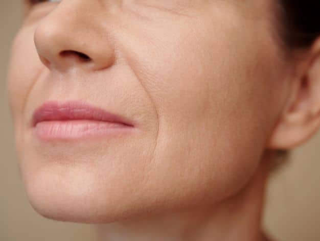 Close-up of a woman's perioral area, showing fine lines and potential benefits of facial exercises and peels.