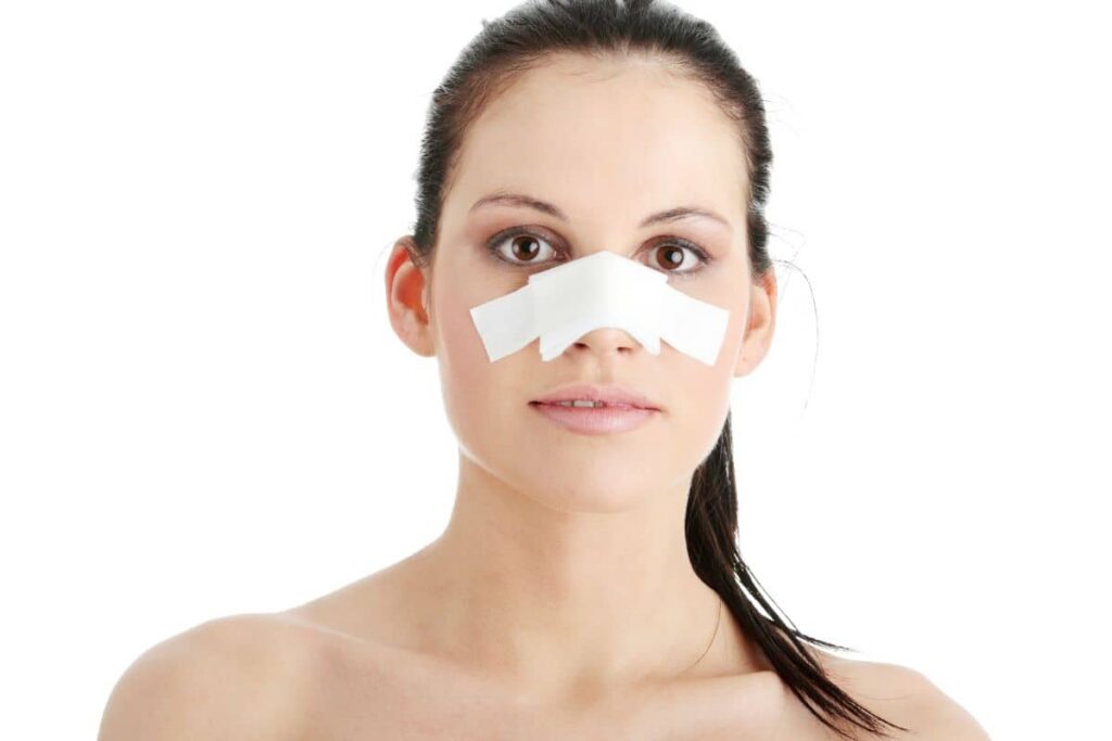 Woman with nasal bandages looking forward, highlighting early-stage rhinoplasty recovery and abnormal swelling signs.